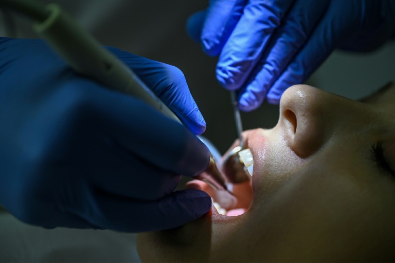 Trouver un dentiste au tarif public est devenu mission quasi impossible pour beaucoup de Britanniques, réduits à s'orienter vers le privé pour ceux qui en ont les moyens, et pour les autres, à se passer de soins pourtant essentiels © Ozan KOSE